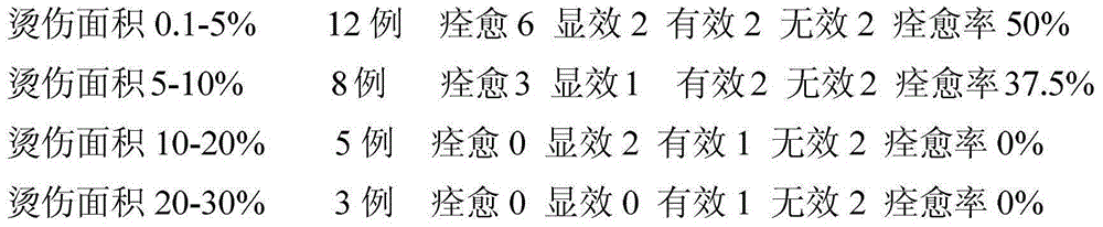 Chinese medicine composition used for treating scalds and preparation method thereof