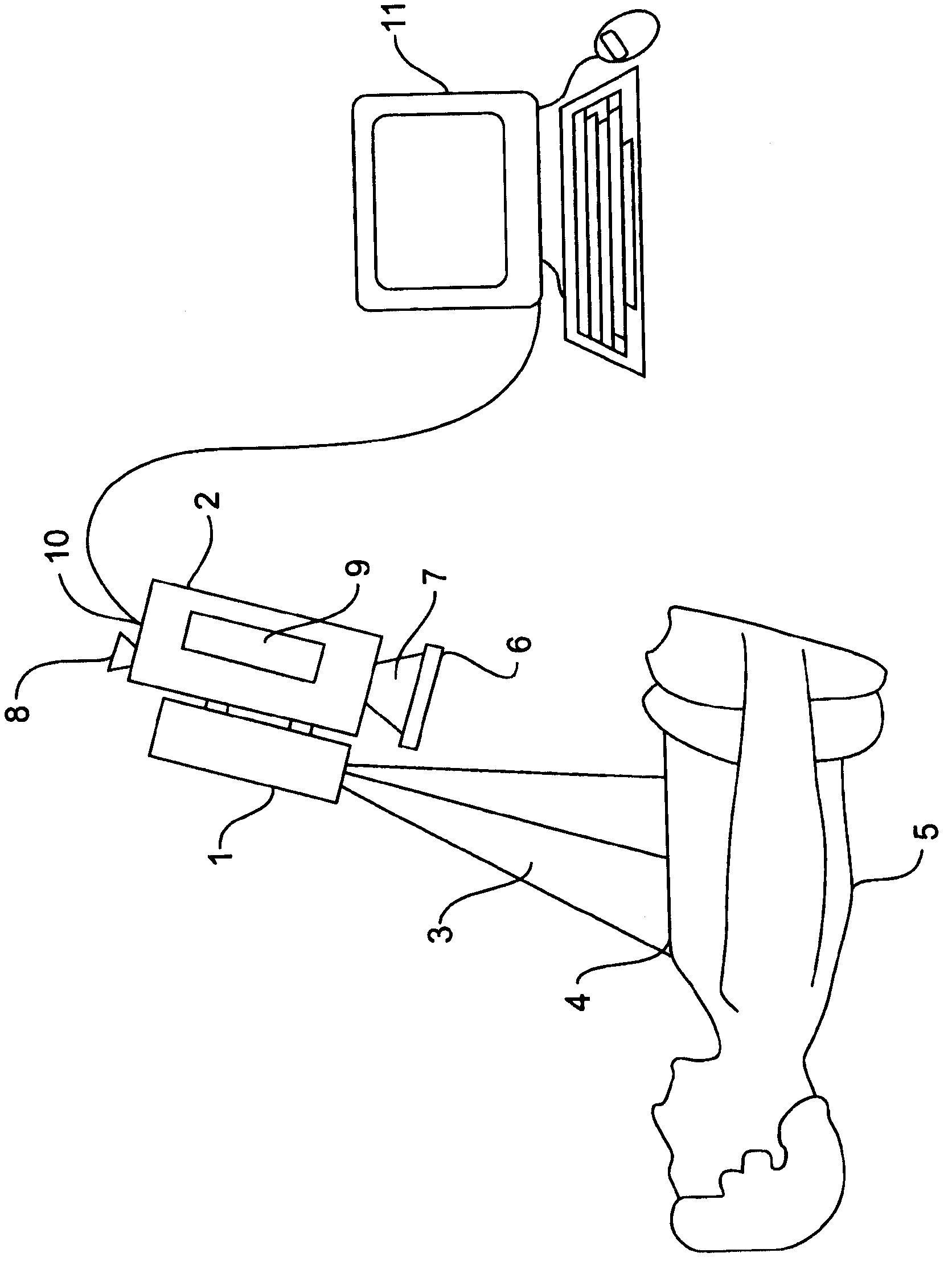 Locating and analyzing perforator flaps for plastic and reconstructive surgery