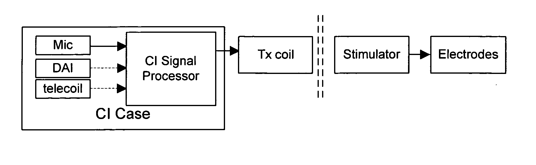 Enhancing cochlear implants with hearing aid signal processing technologies