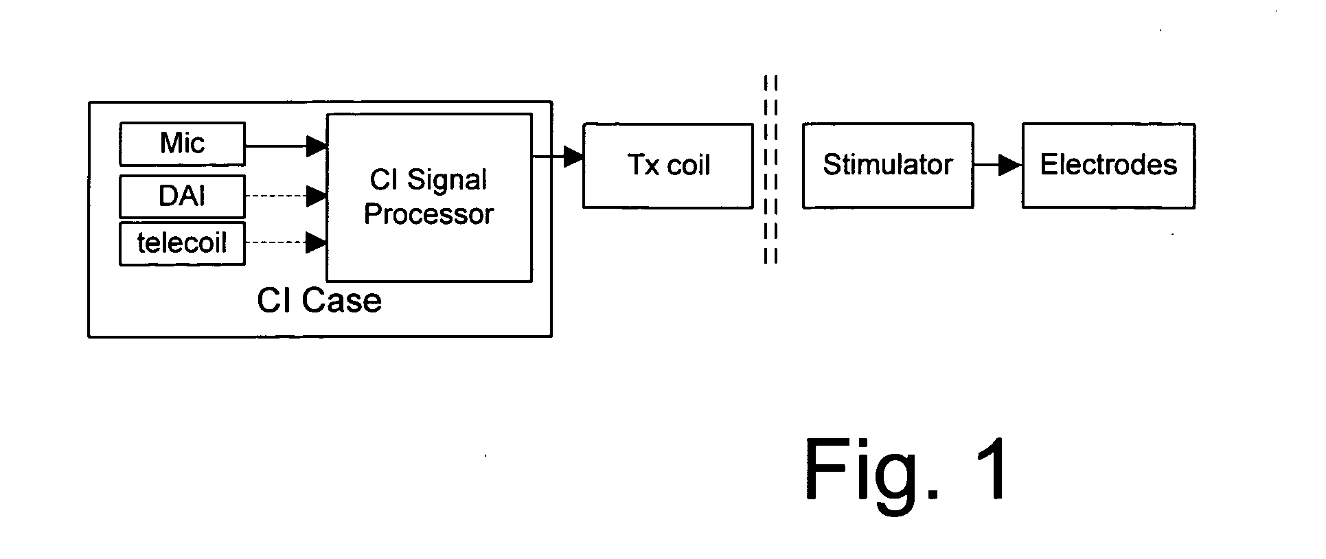 Enhancing cochlear implants with hearing aid signal processing technologies