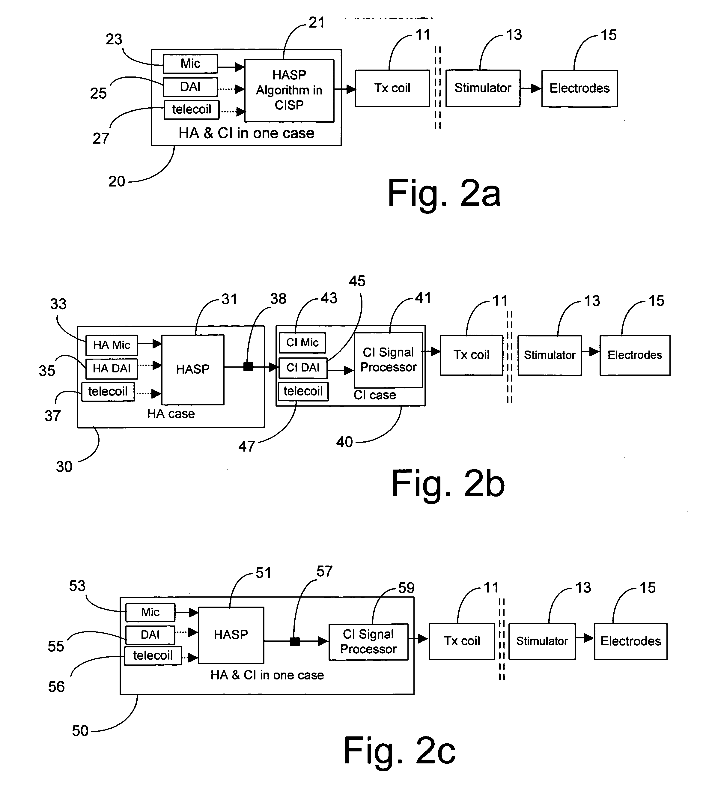 Enhancing cochlear implants with hearing aid signal processing technologies