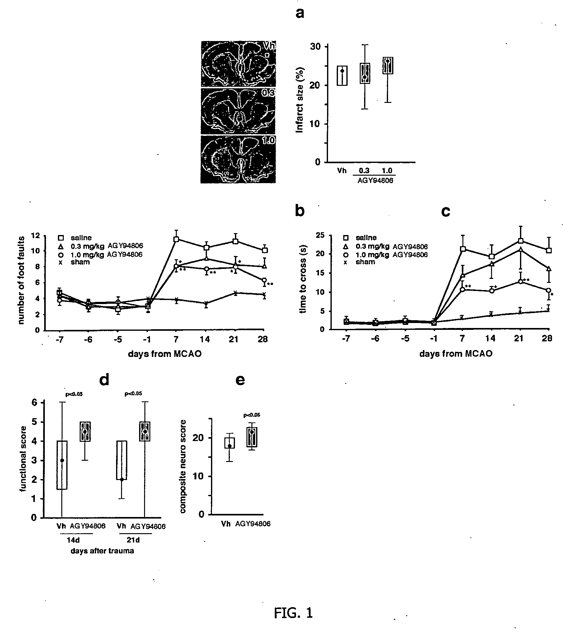 Sigma ligands for neuronal regeneration and functional recovery