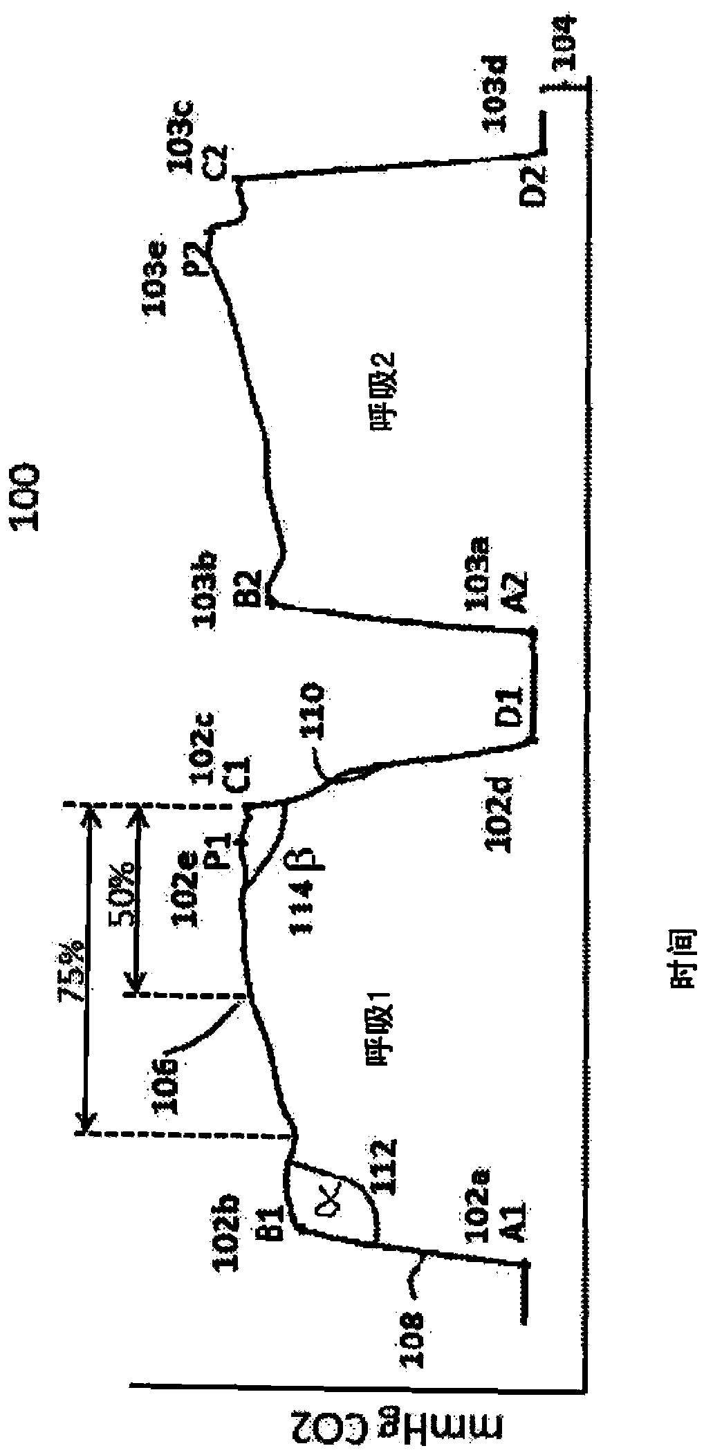 Capnography system for automatic diagnosis of patient condition