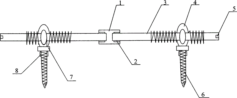 Novel self-rotating spine-distracting internal fixation system