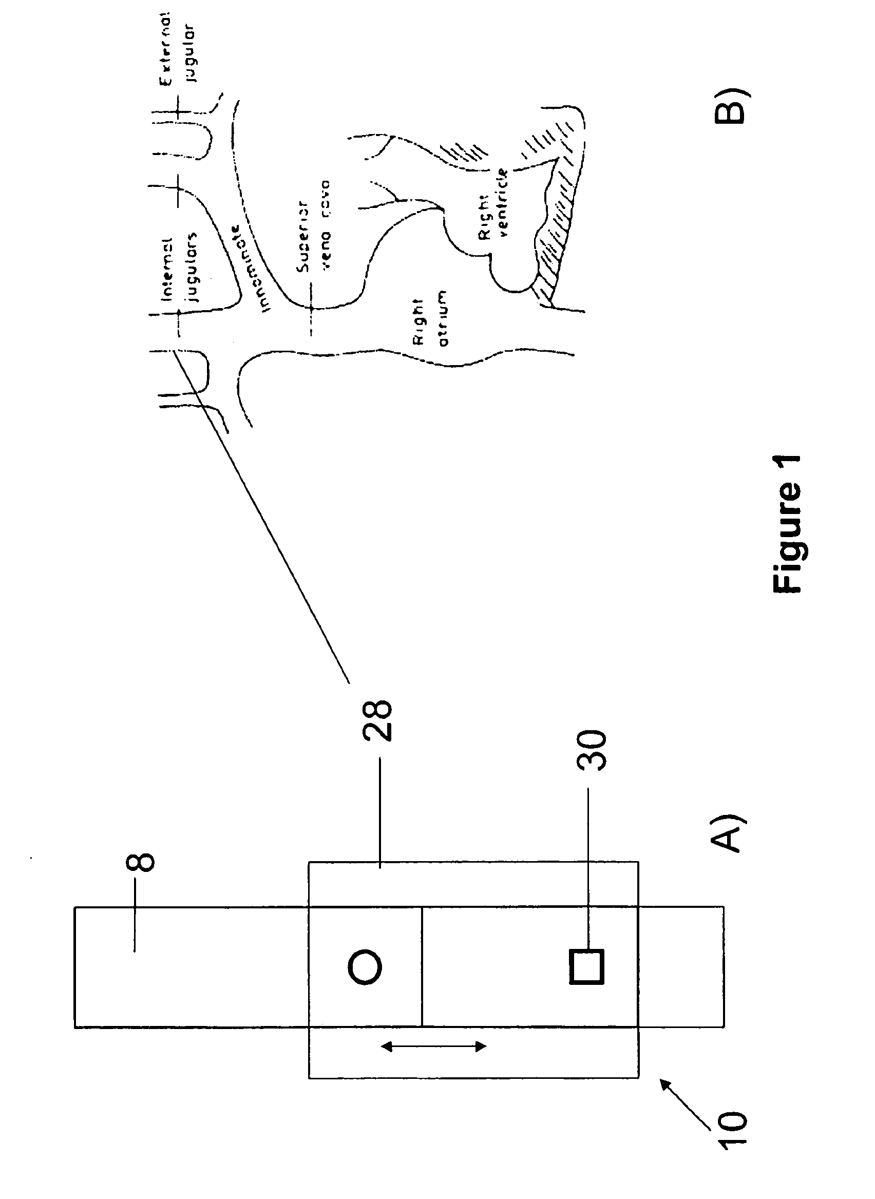 Method and device for measuring parameters of cardiac function