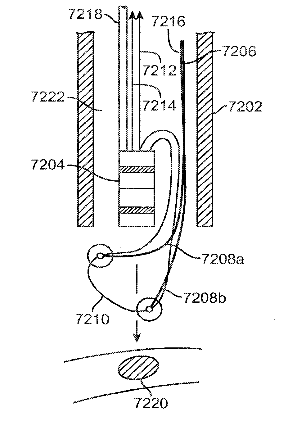 Knotless suture anchor and methods of use