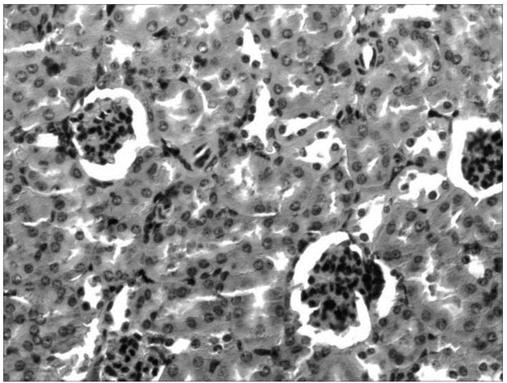 Preparation method for extracting edible and medicinal monomer for preventing and treating hyperuricemia and gout from Semen Cuscutae