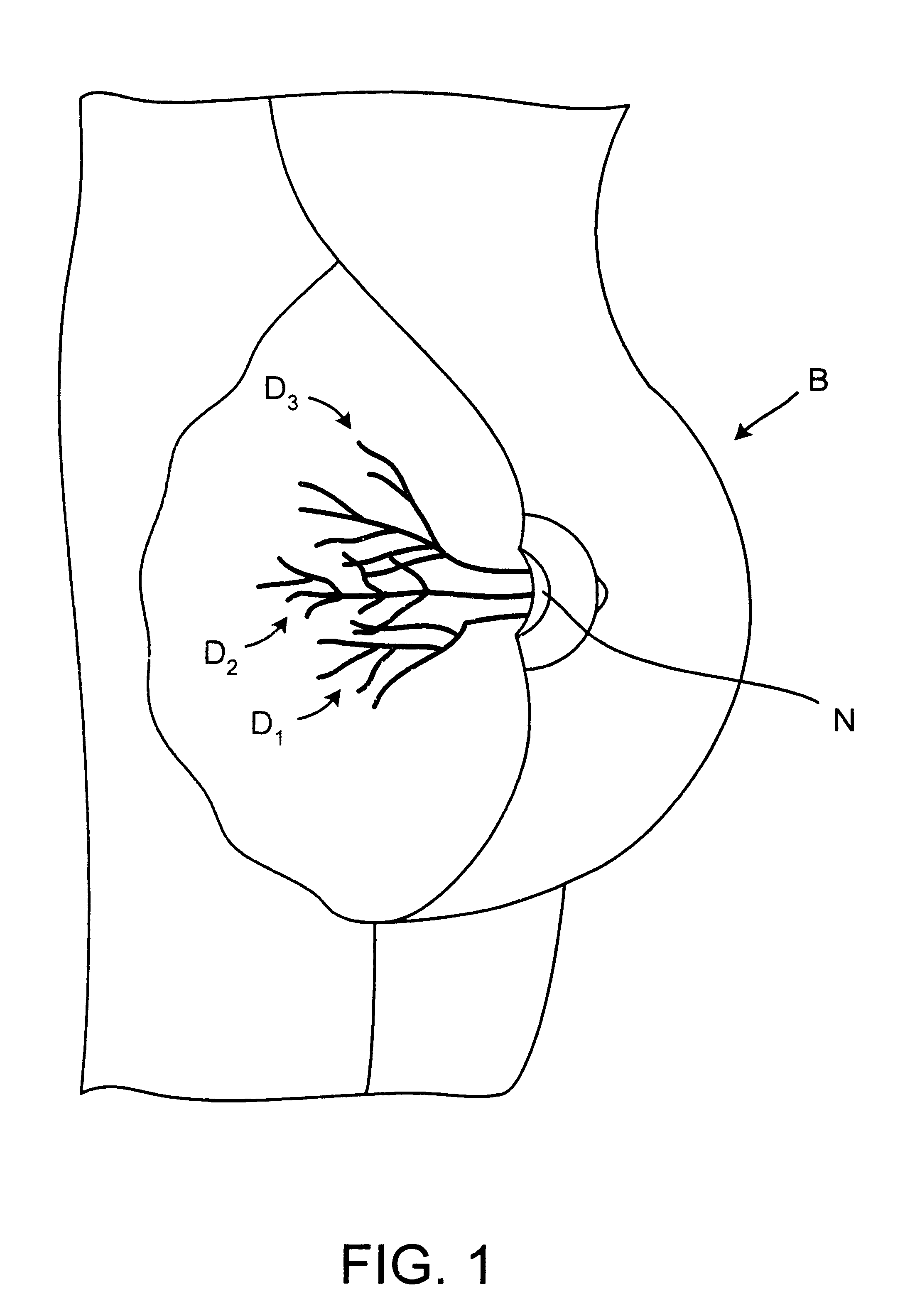 Methods and kits for identifying ductal orifices in a nipple