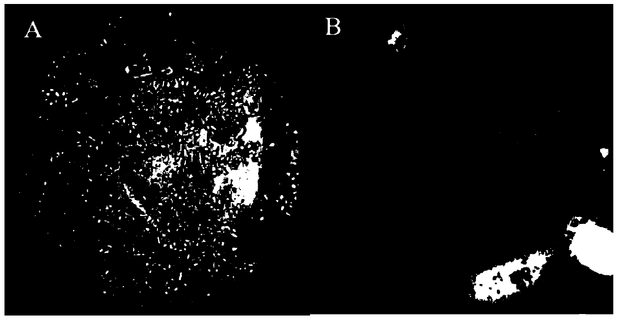 Compound microbial deodorant, preparation method and application thereof