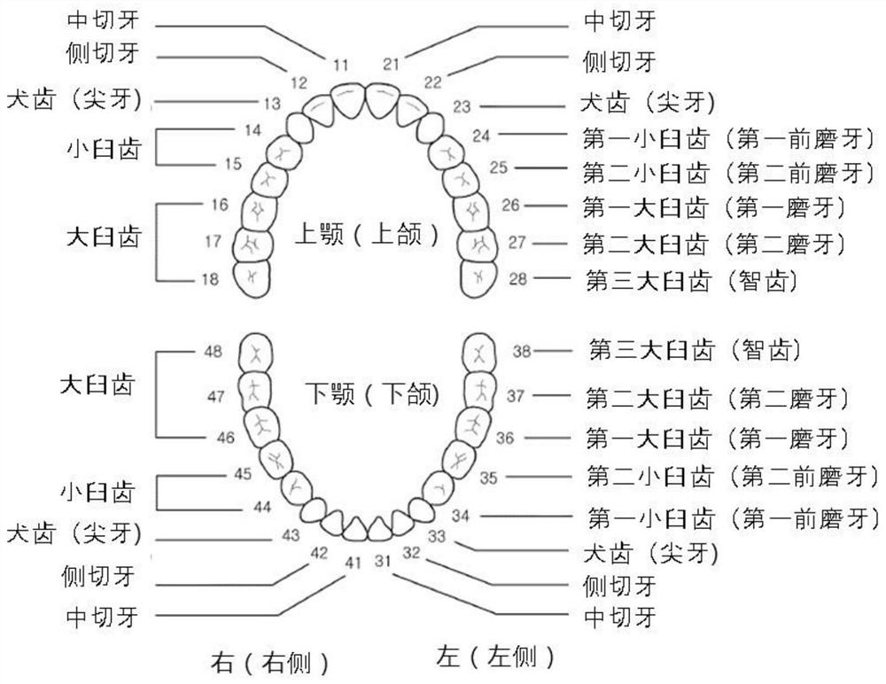 Methods, apparatus and computer programs for planning implant surgery