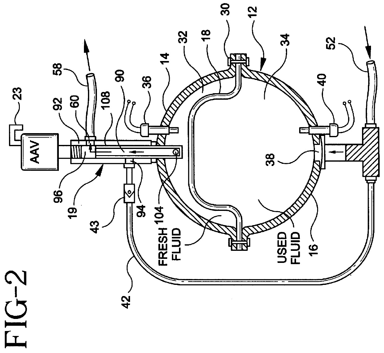 Fluid exchange apparatus