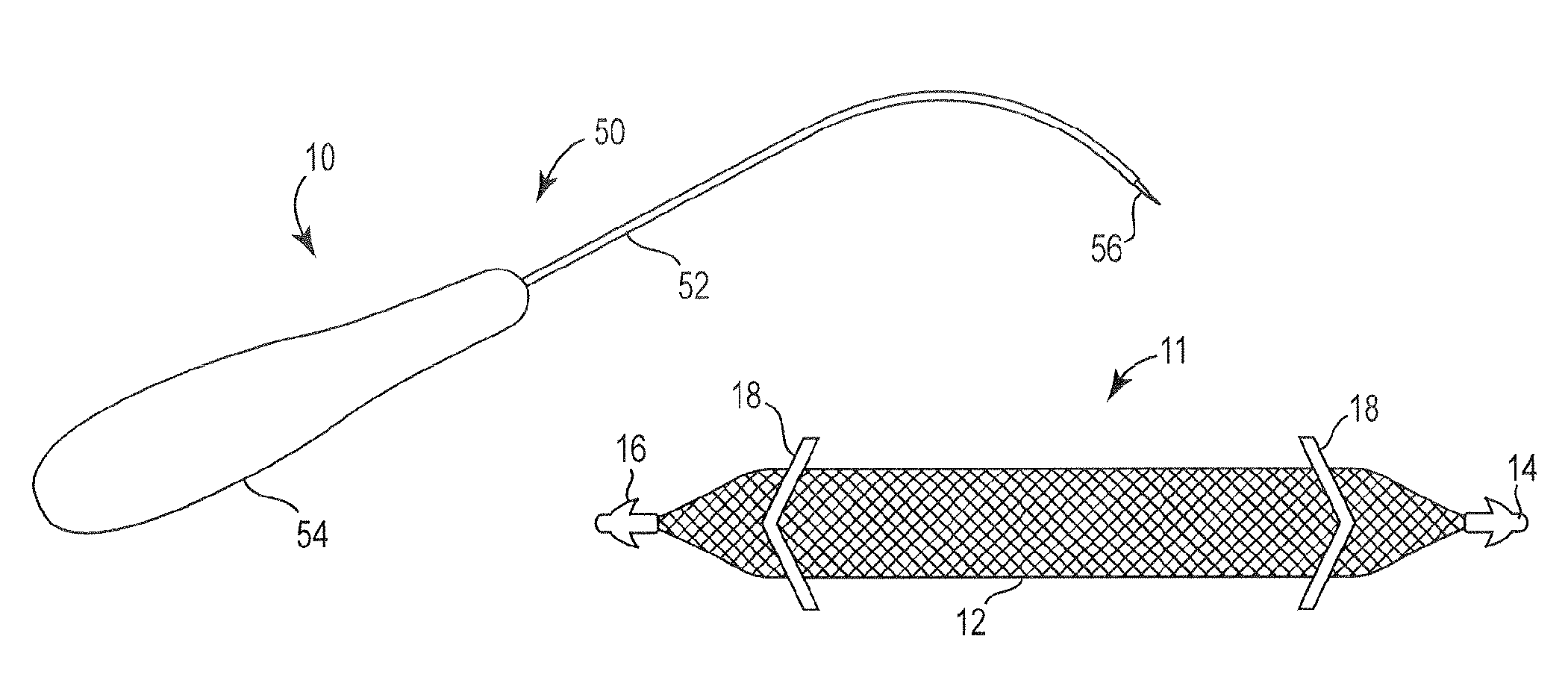 Pelvic implant system and method