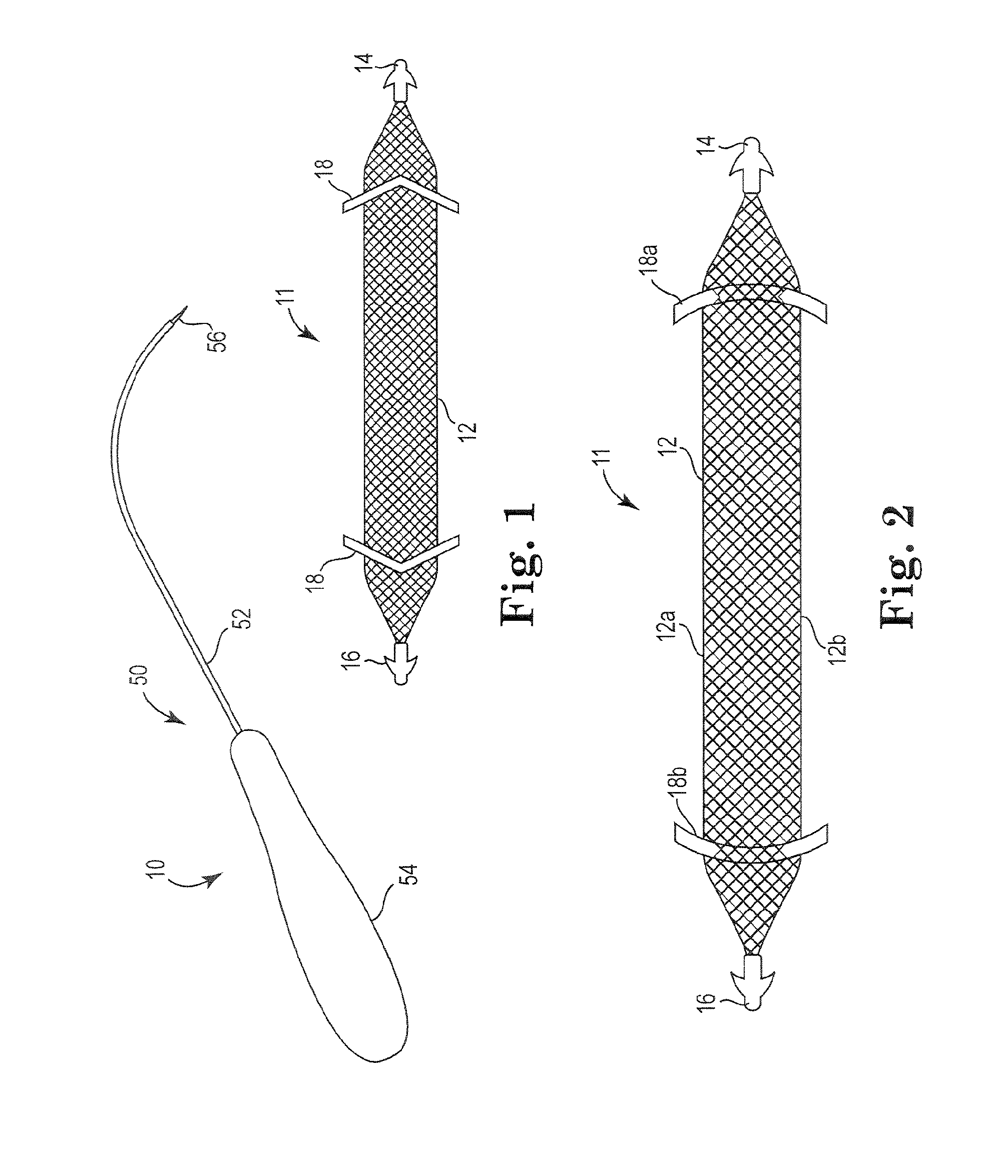 Pelvic implant system and method