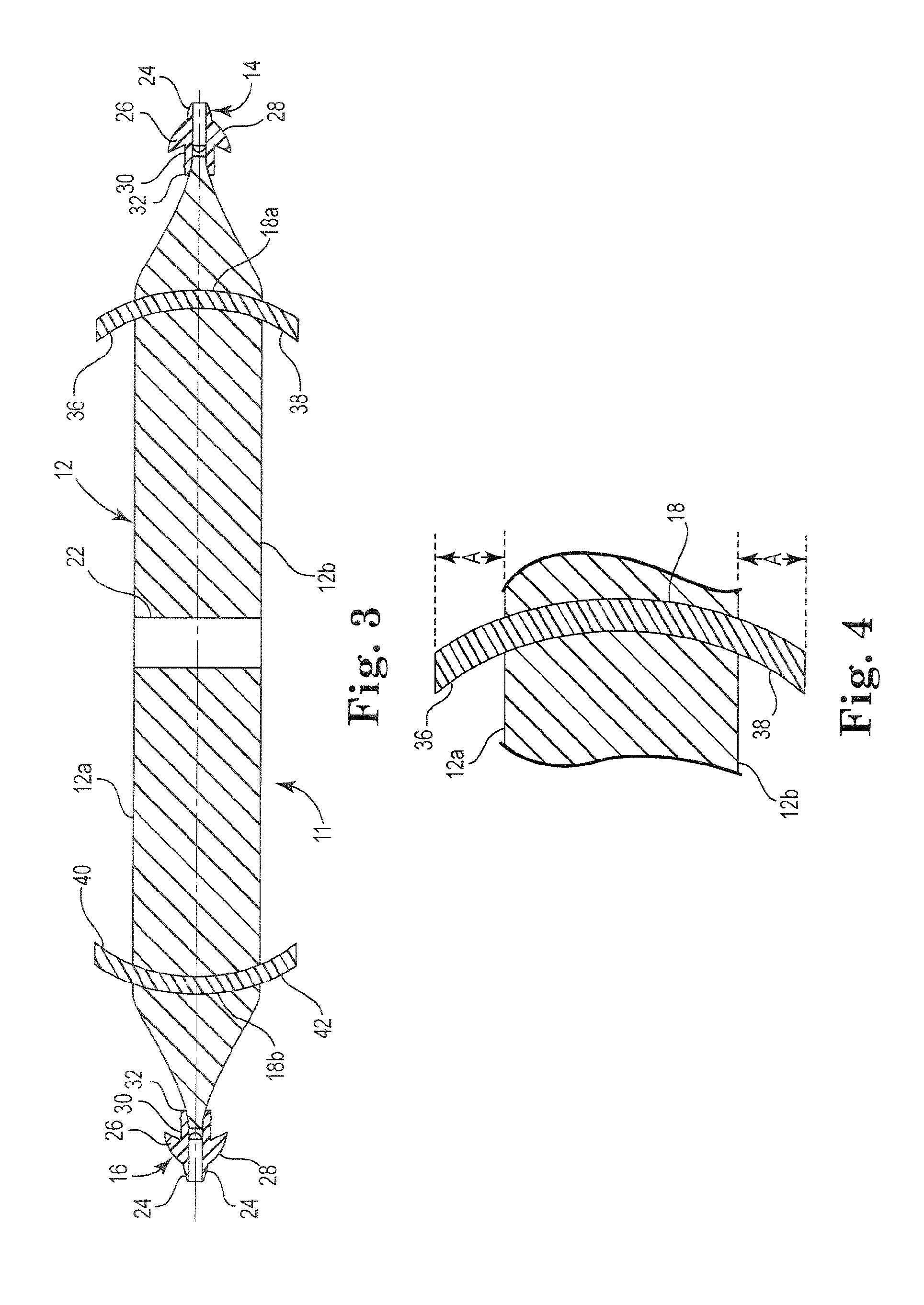 Pelvic implant system and method