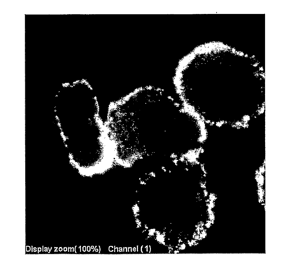 Tumor Specific Antibody