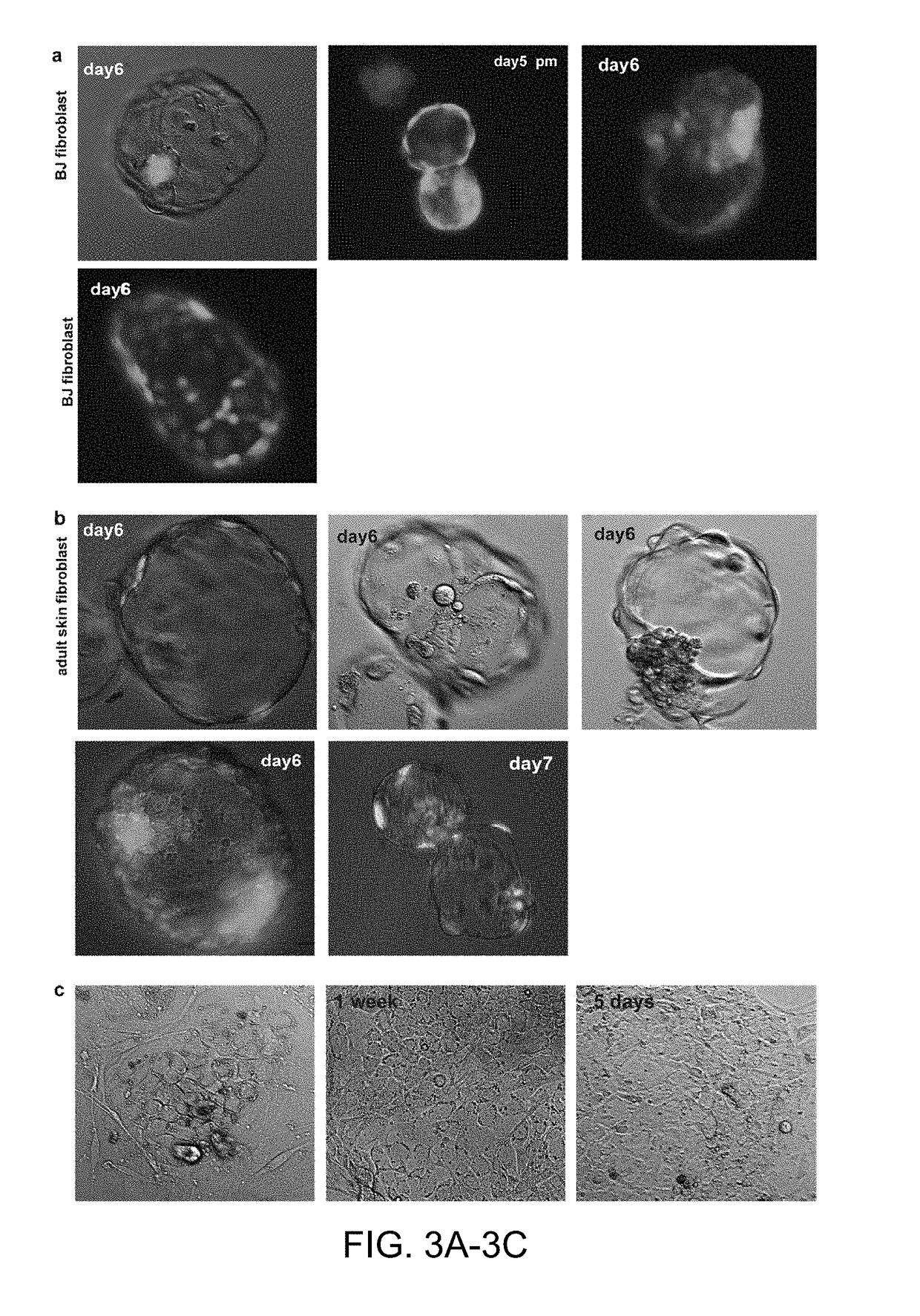 Somatic cell nuclear transfer methods