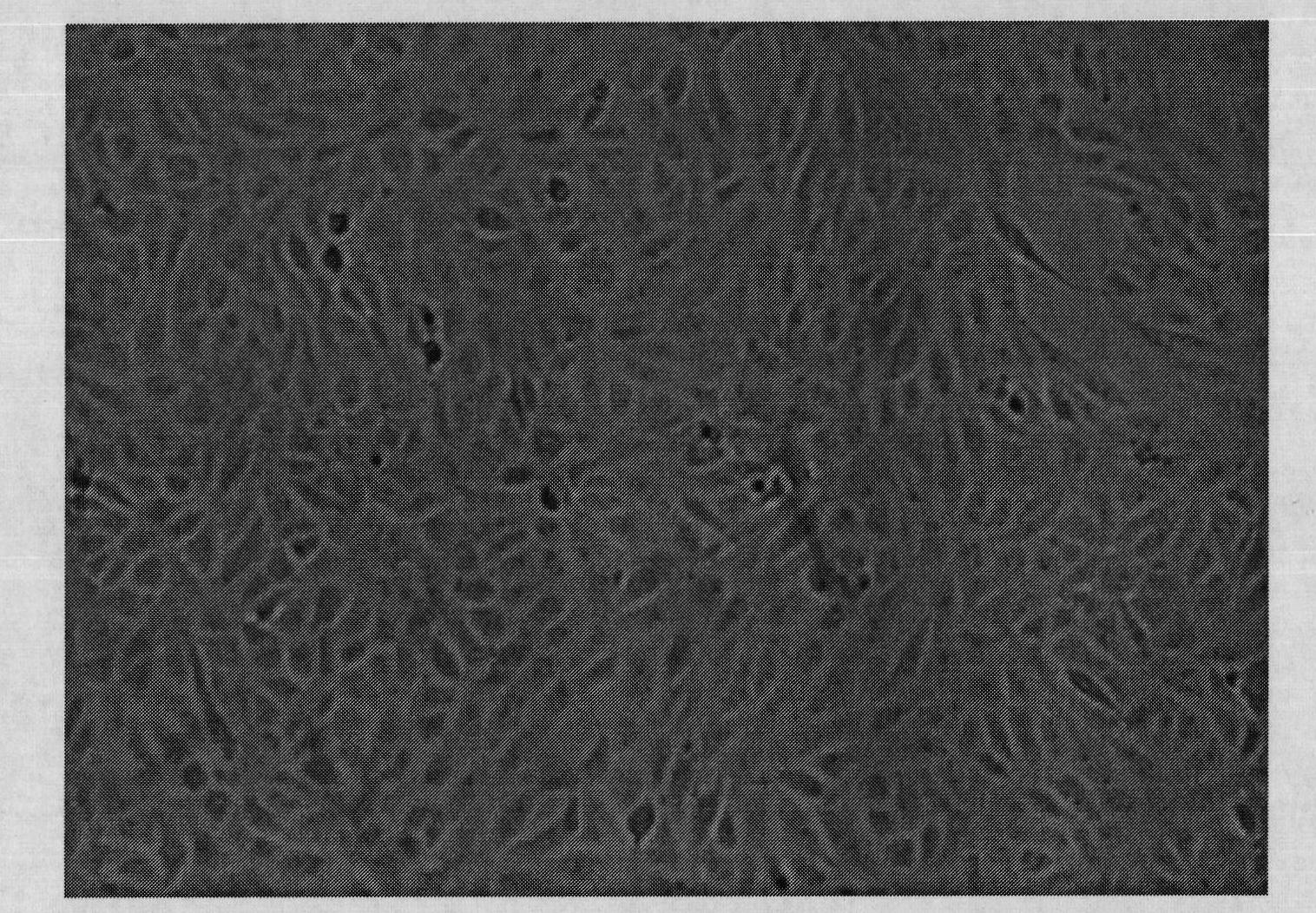 Serum-free culture medium without animal origin components for culturing Vero cell micro-carrier