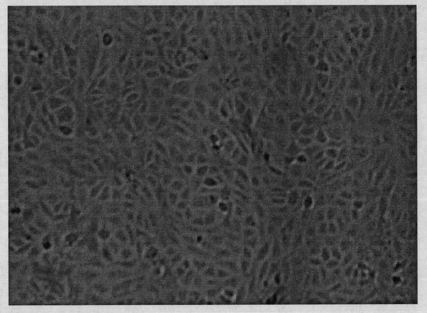 Serum-free culture medium without animal origin components for culturing Vero cell micro-carrier