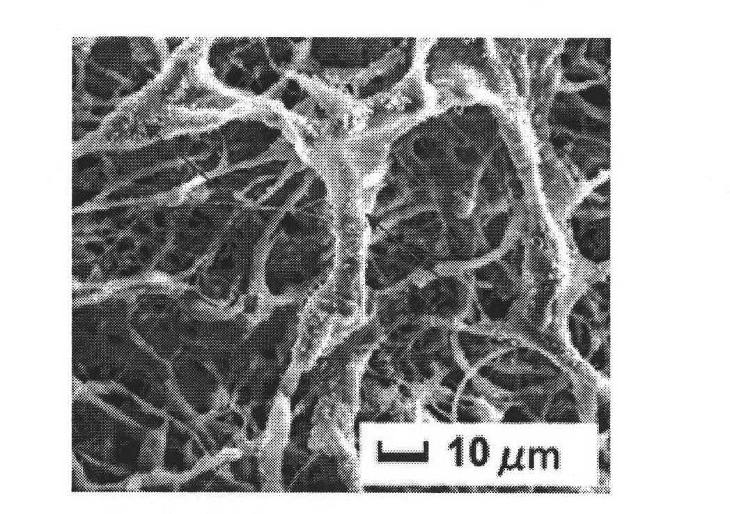 Three-dimensional nano stent of gene delivery system, preparation method and application thereof