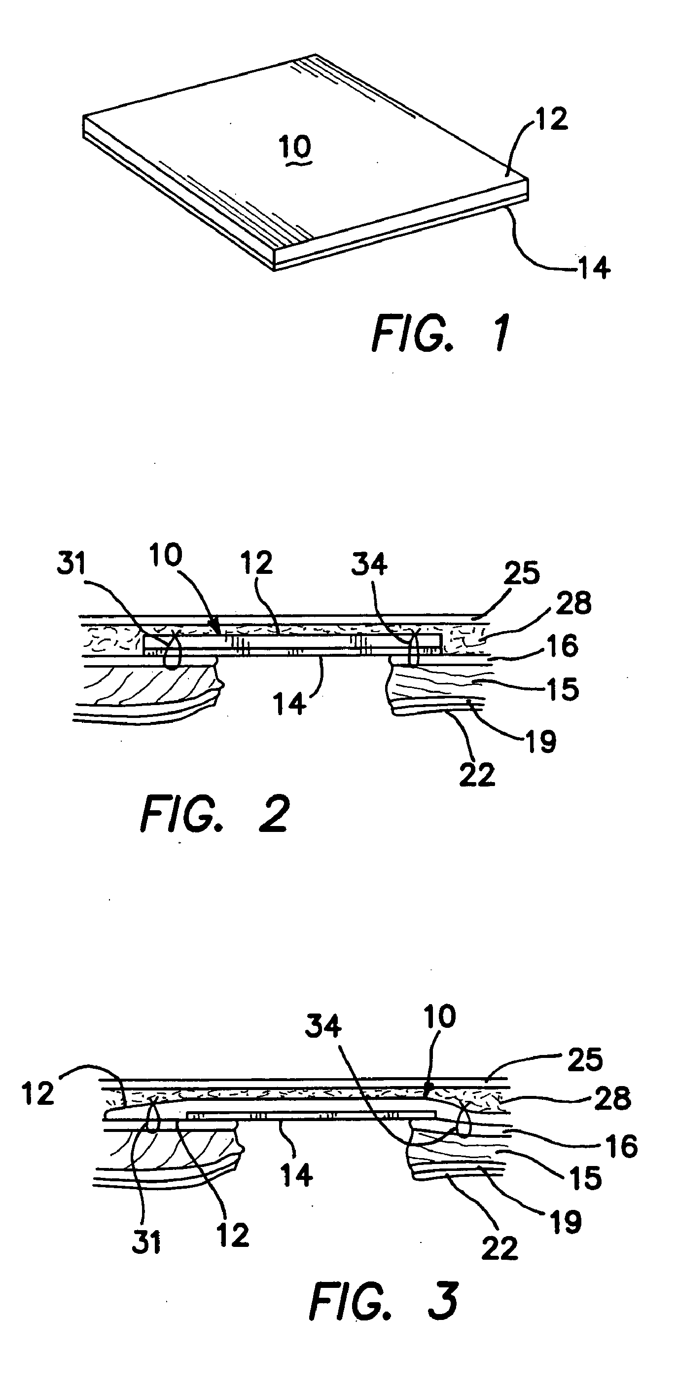 Surgical prosthesis having biodegradable and nonbiodegradable regions