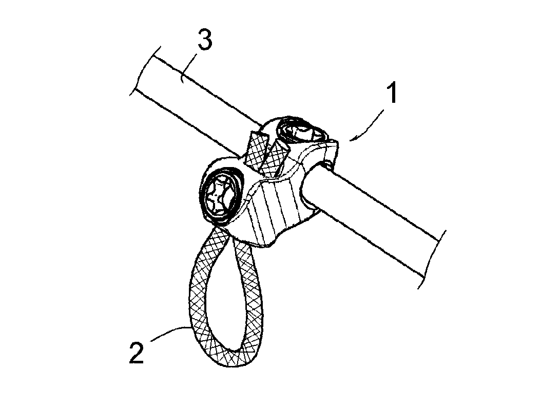 Vertebral osteosynthesis equipment