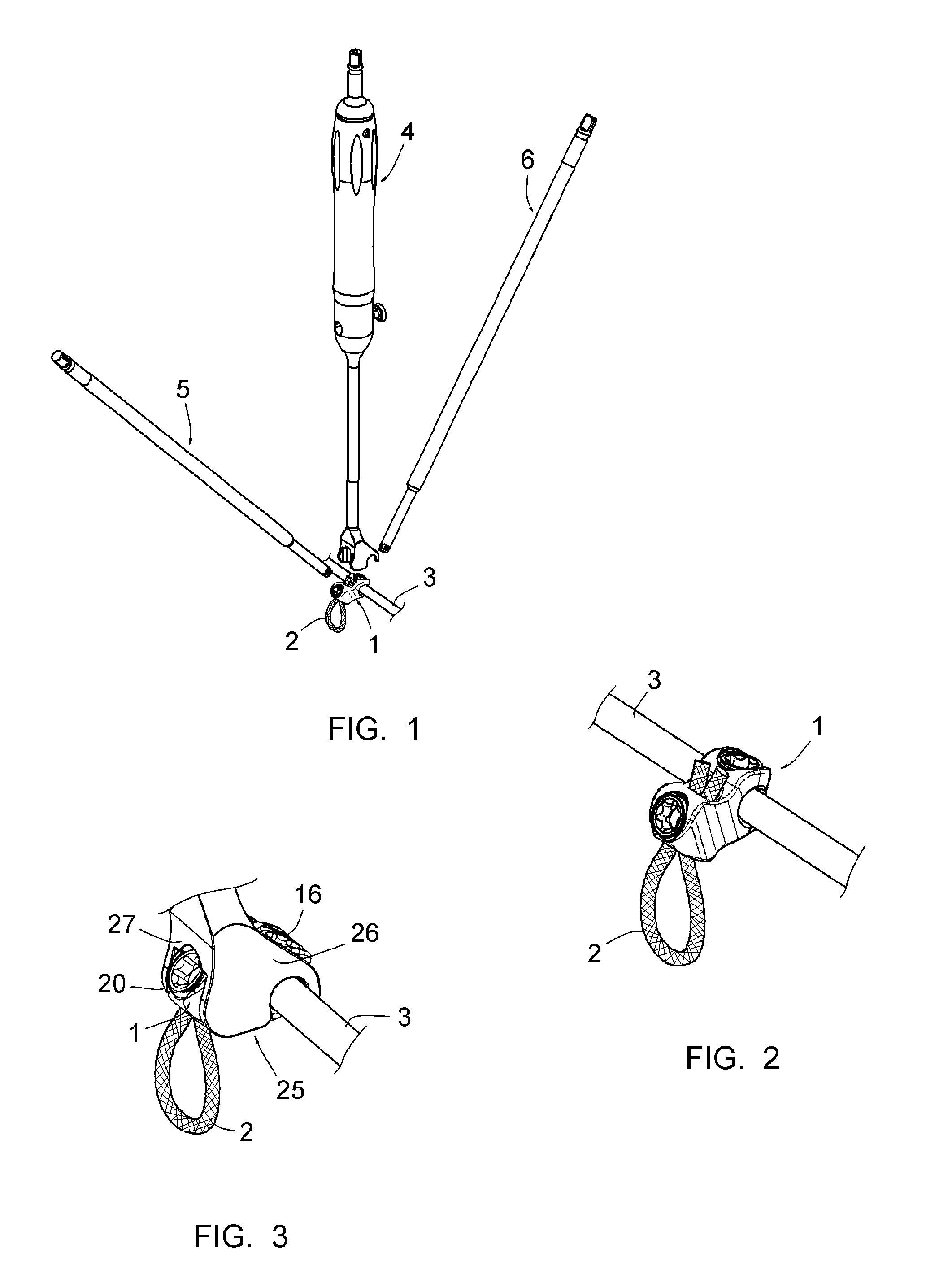 Vertebral osteosynthesis equipment