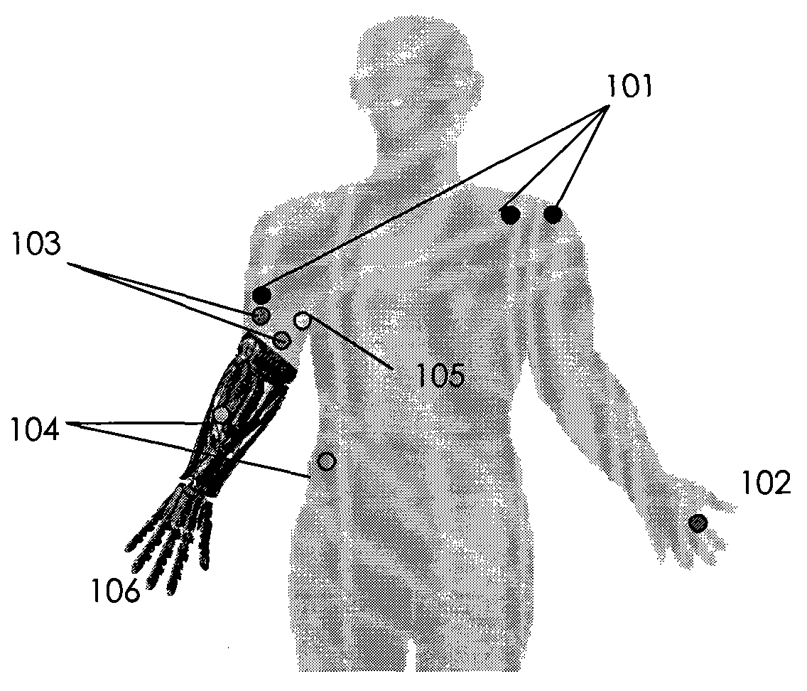 Novel remote rehabilitation and treatment device based on body feel network