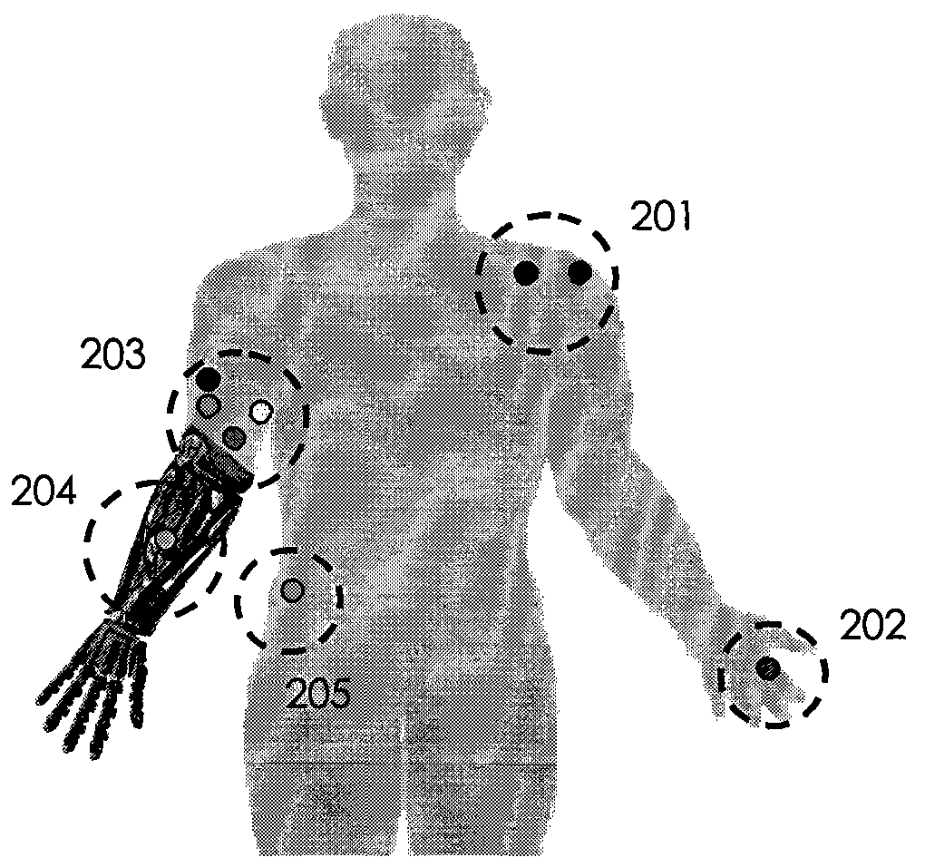 Novel remote rehabilitation and treatment device based on body feel network