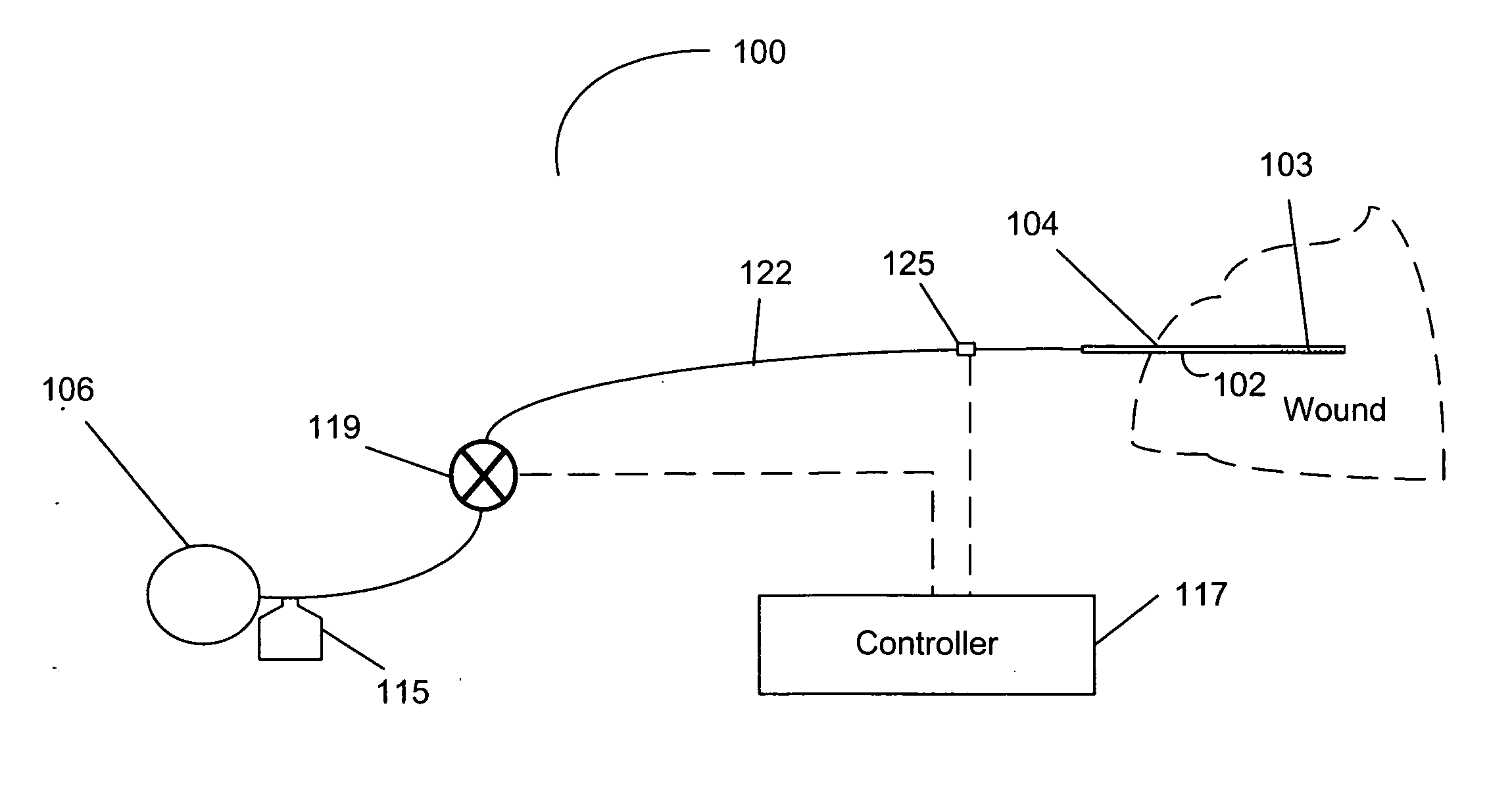 Wound drainage suction relief