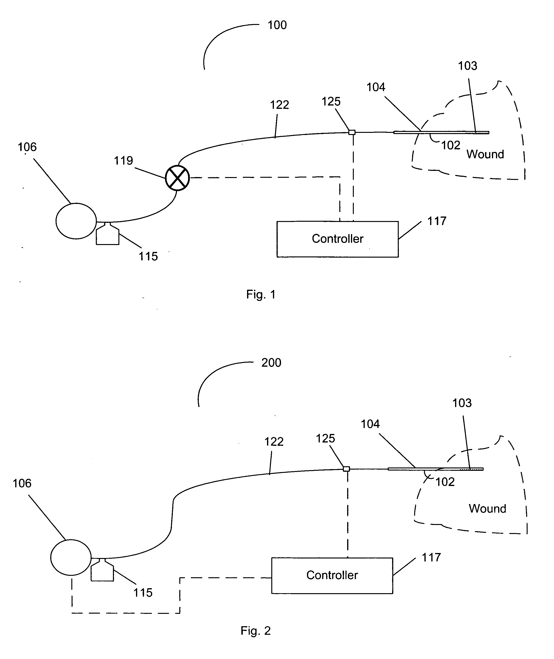 Wound drainage suction relief