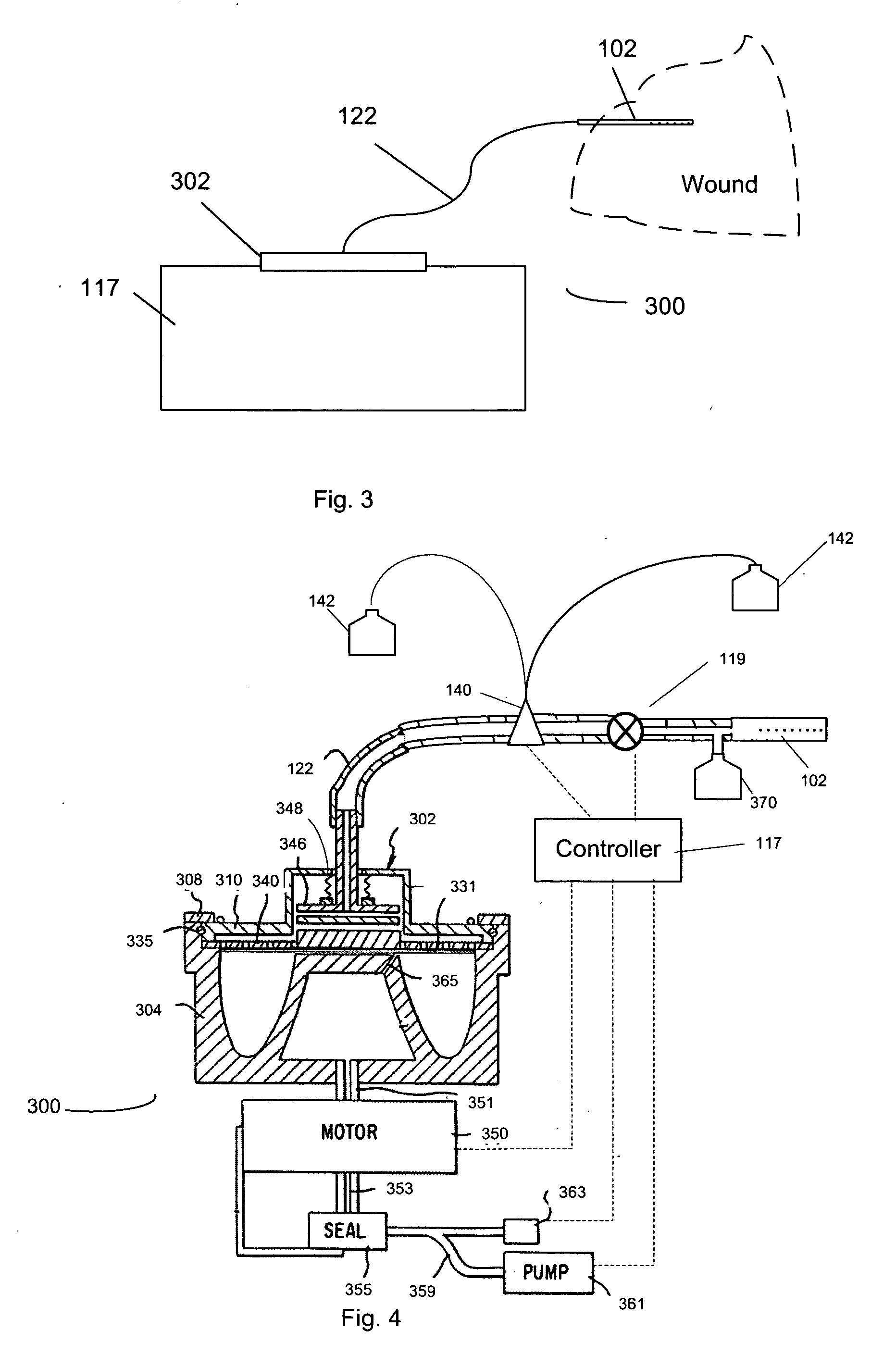 Wound drainage suction relief