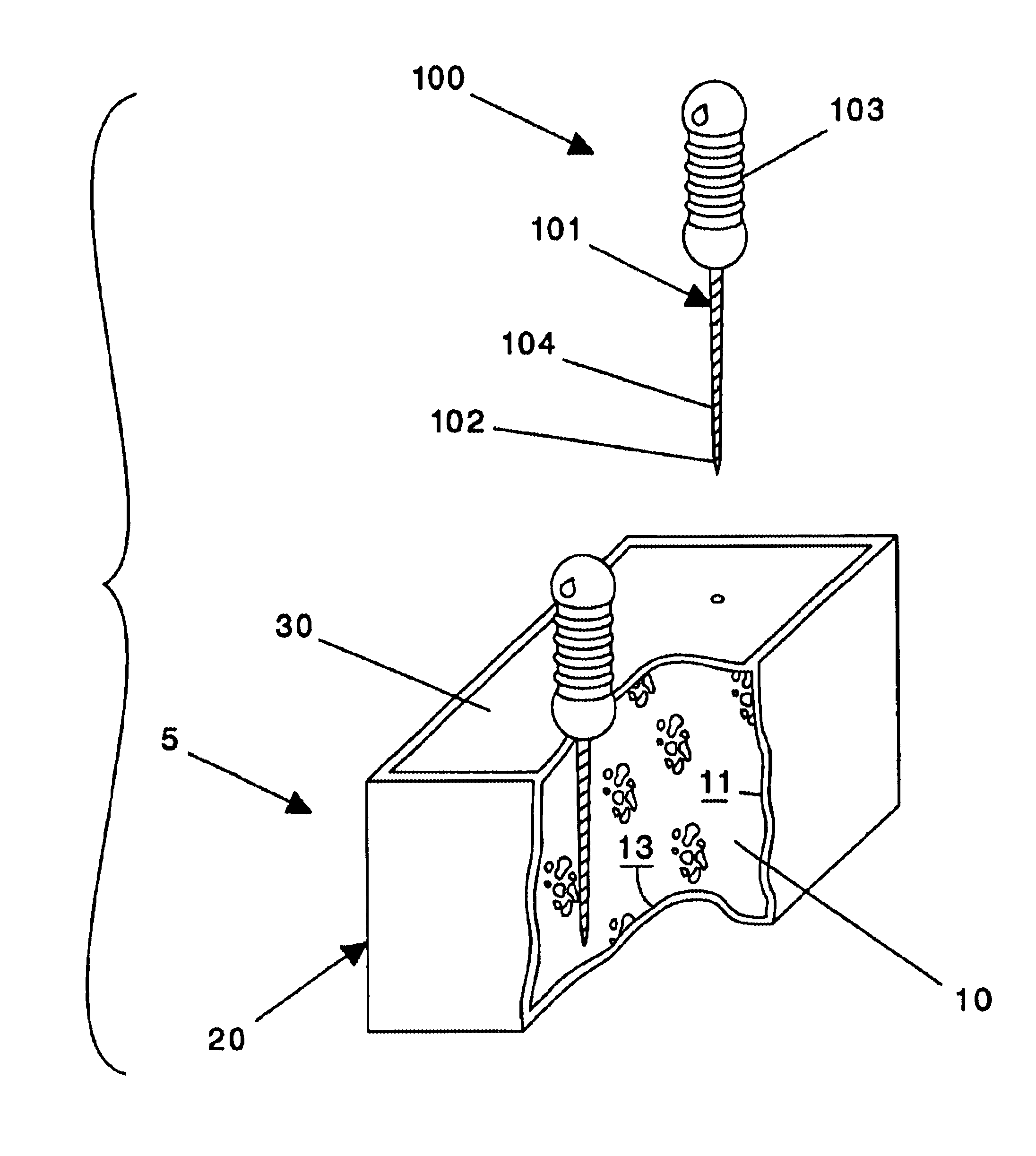 Device and method for cleaning and detecting fractures in files