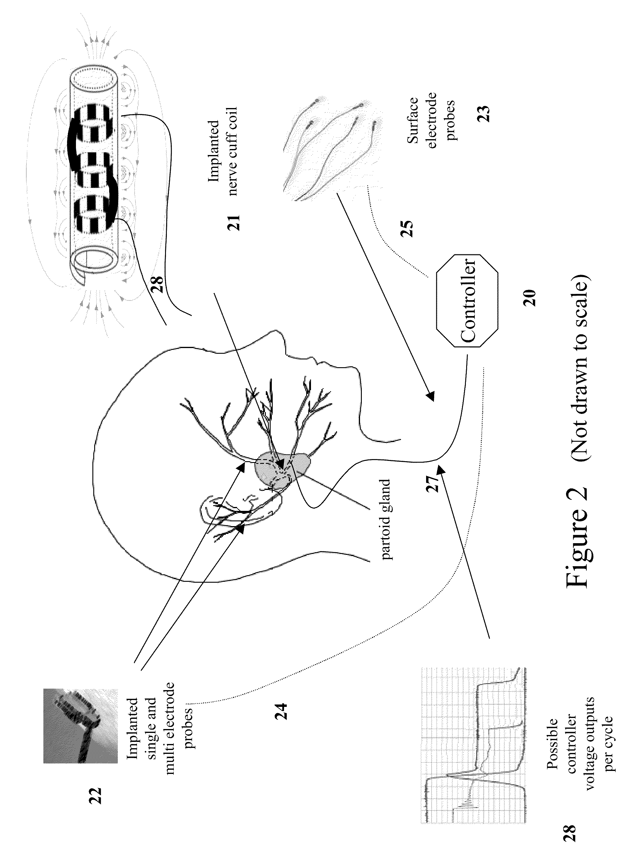 Induced modulation of neuronal transmission