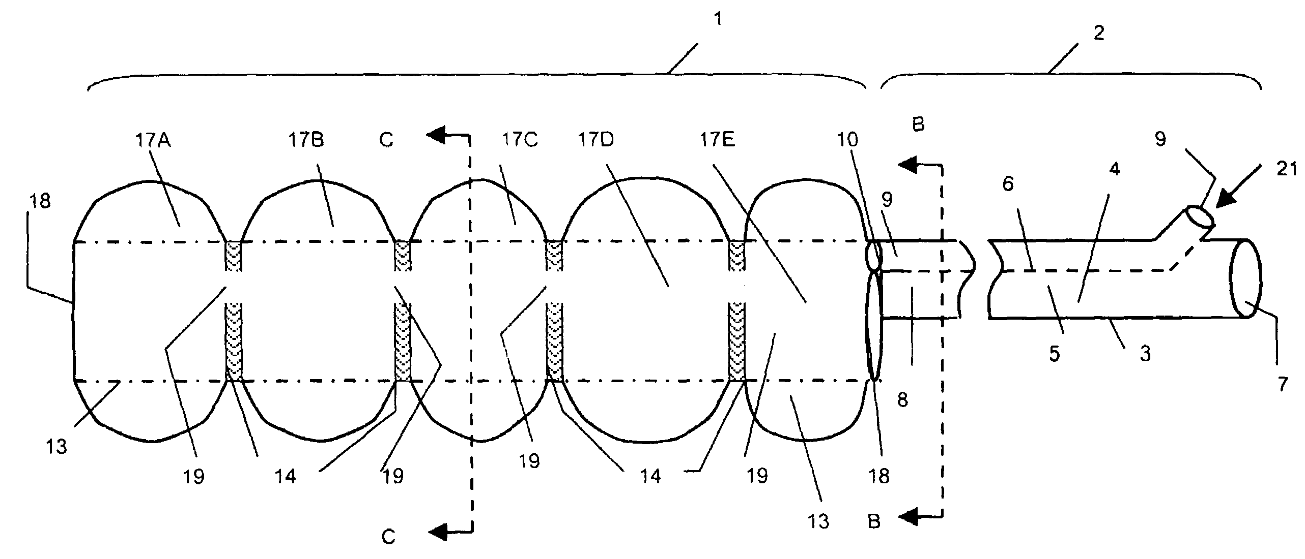 Endovascular balloon graft