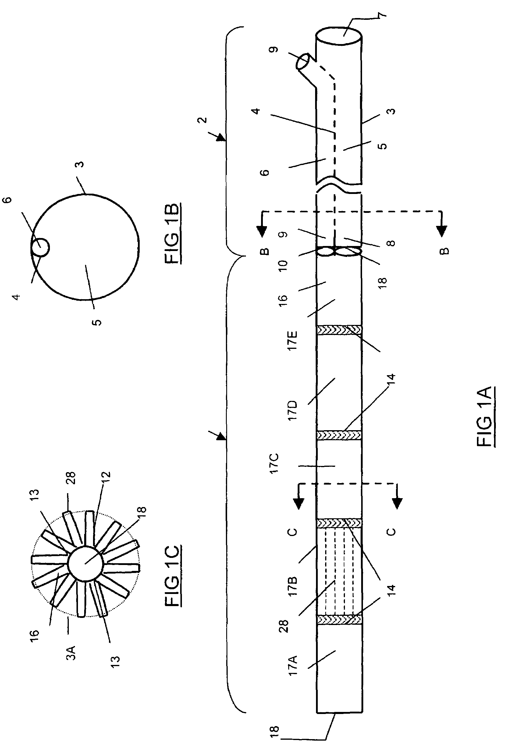 Endovascular balloon graft