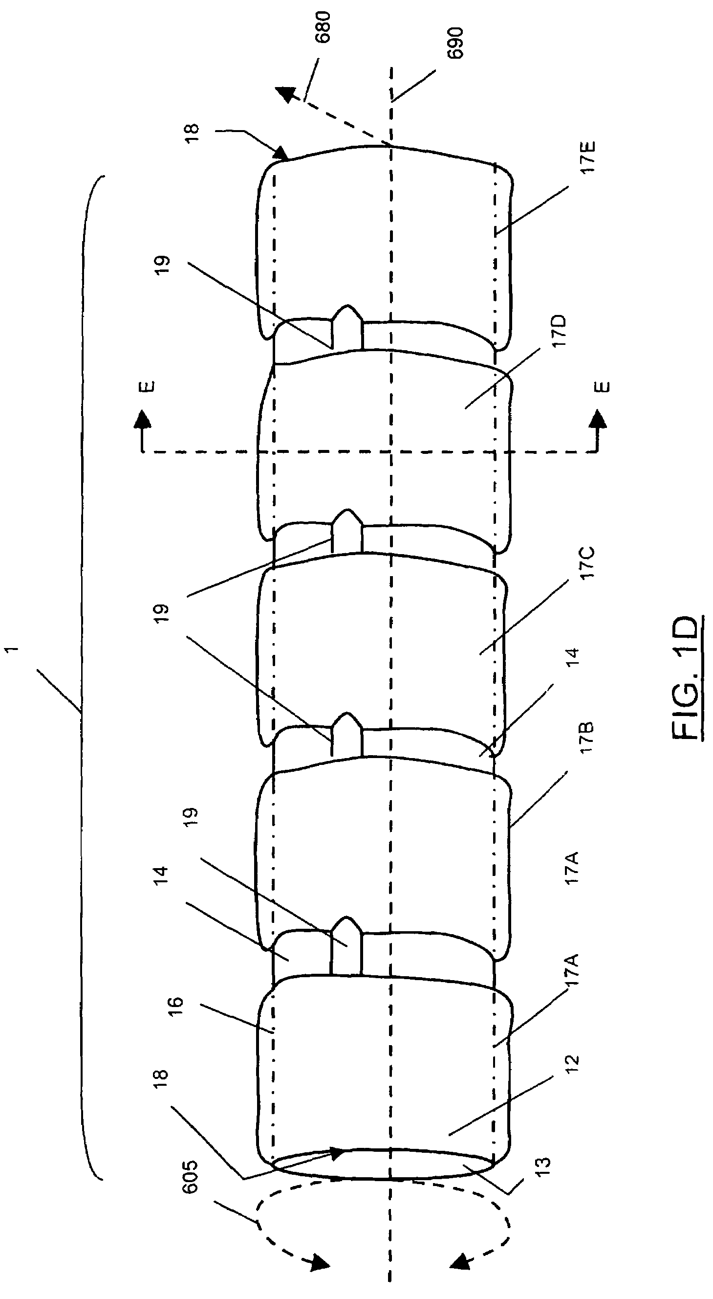 Endovascular balloon graft