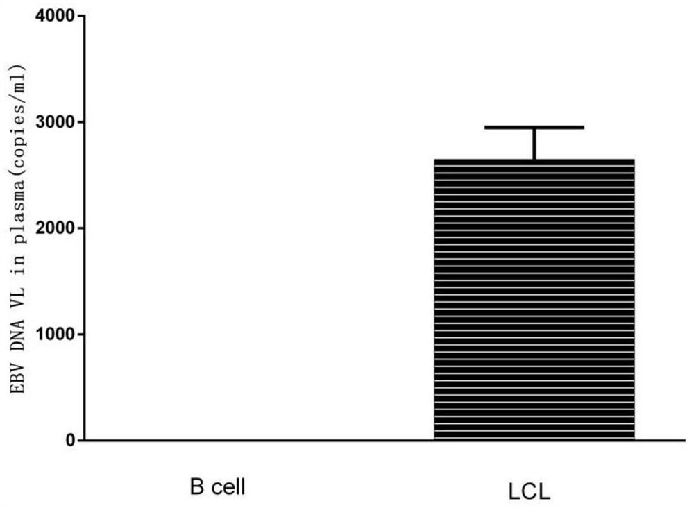 EBV (Epstein-Barr Virus) composite antigen, dendritic cell vaccine and application thereof