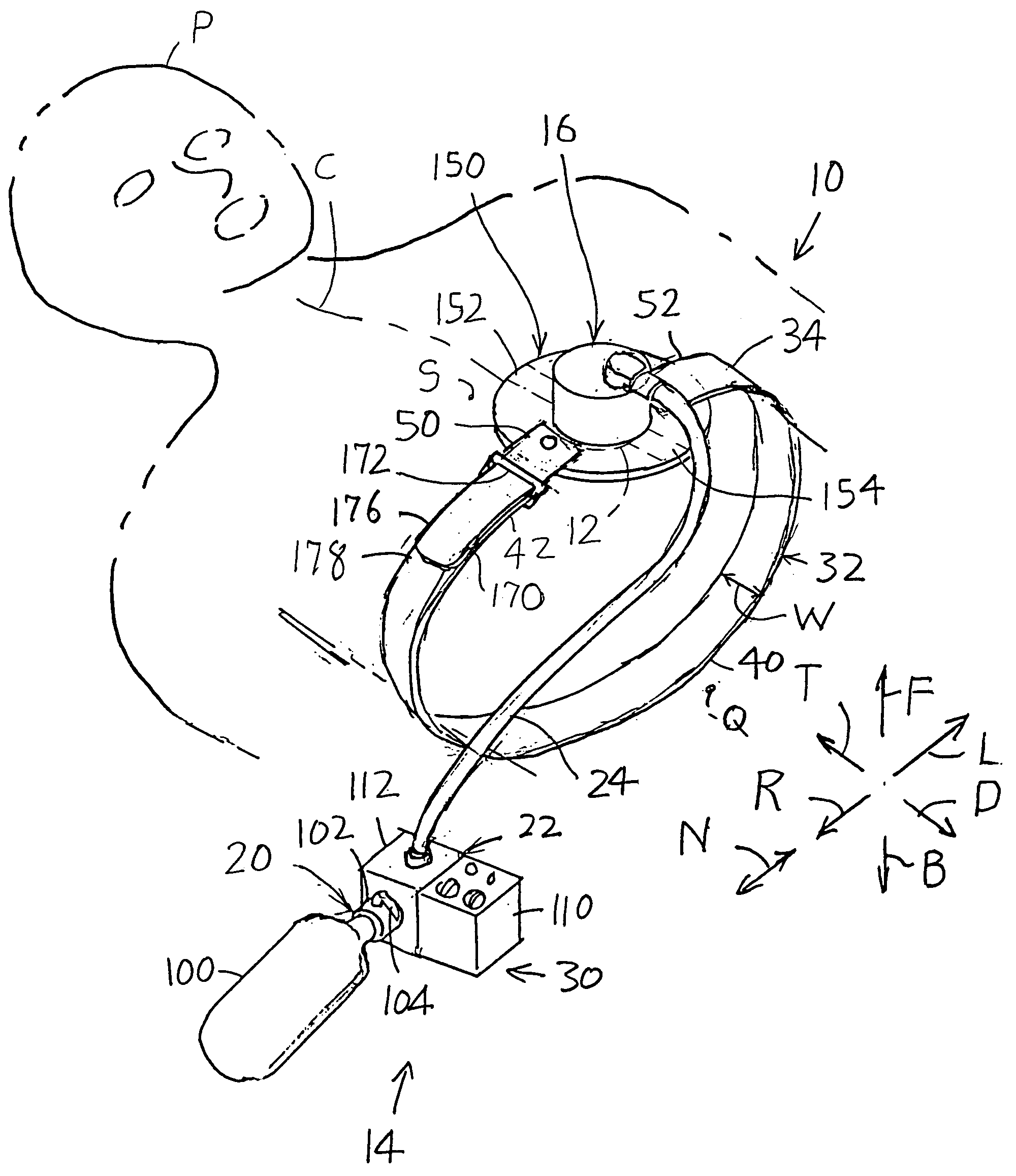 Chest compressor