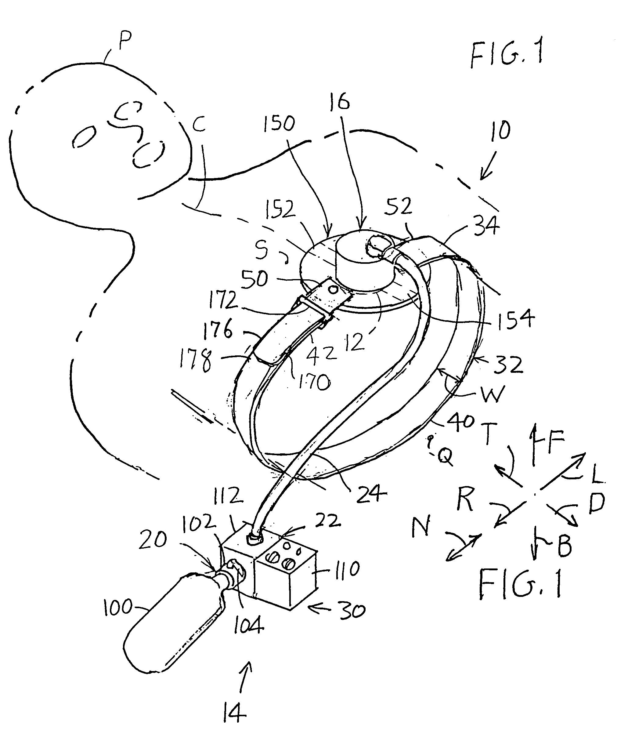 Chest compressor