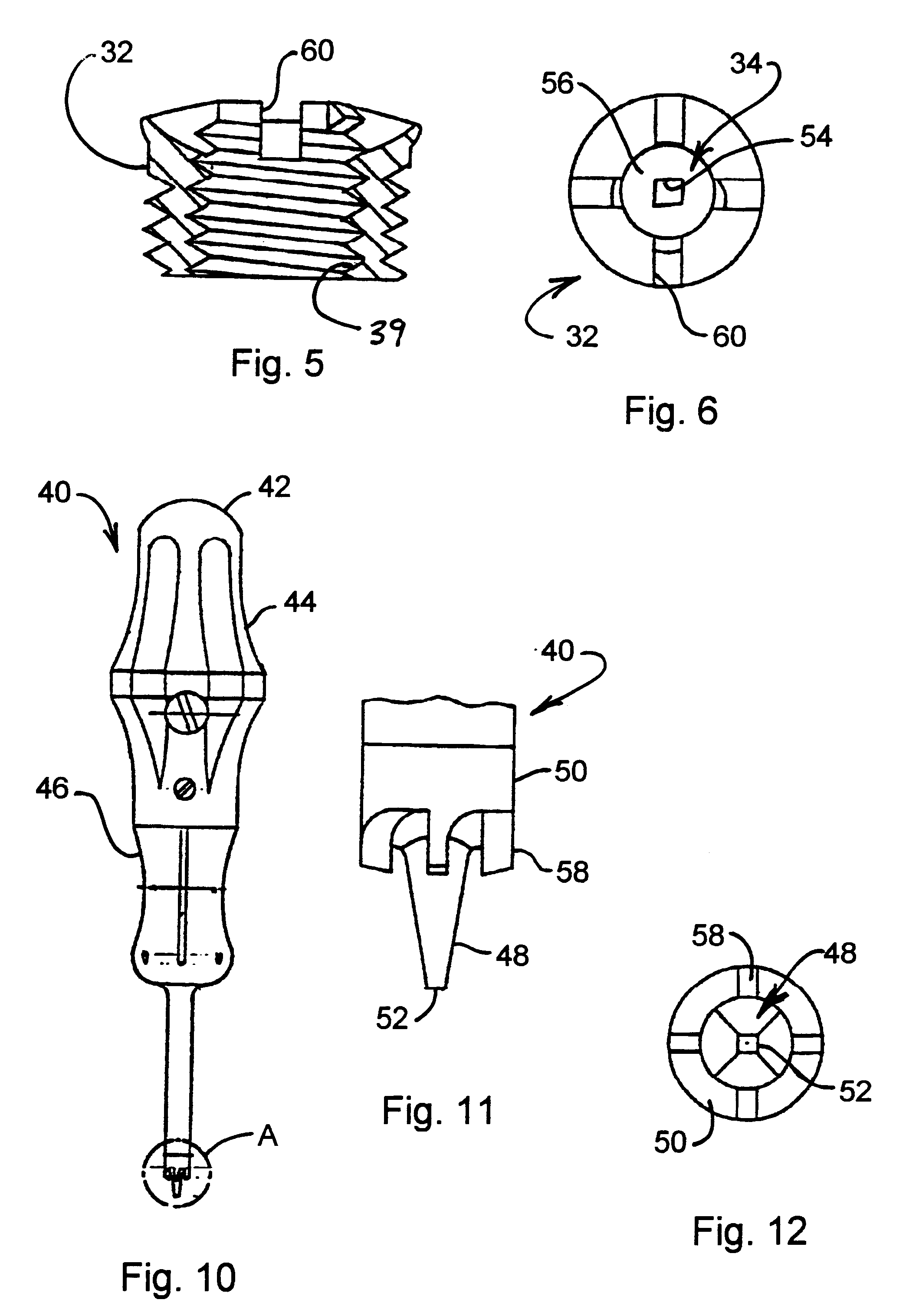 Method and apparatus for mandibular osteosynthesis