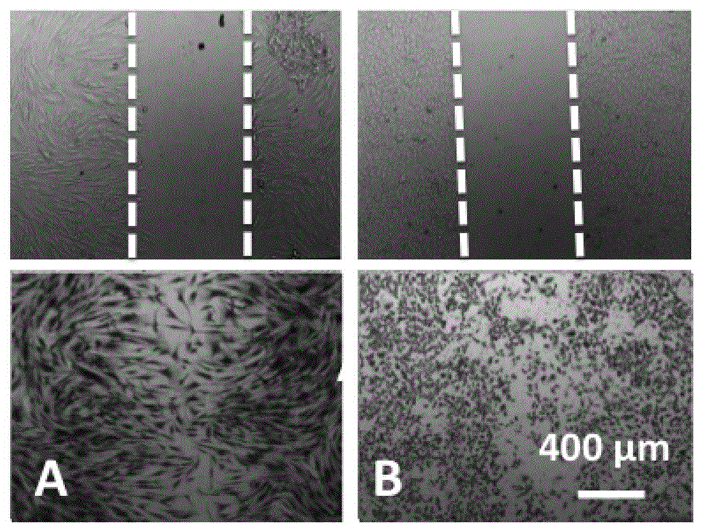 Temperature-sensitive type skin wound dressing as well as preparation method and applications thereof