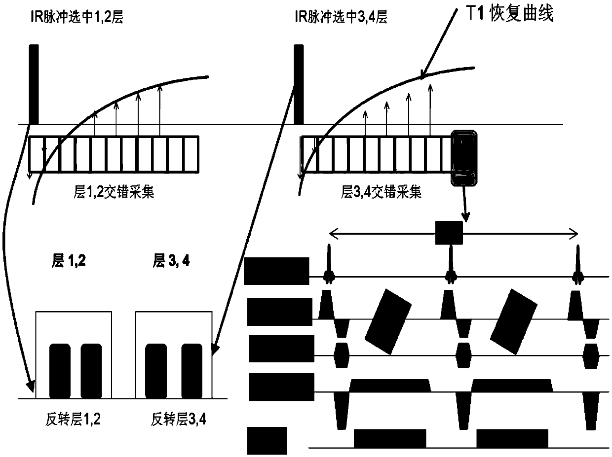 Brain longitudinal relaxation value measuring method and apparatus