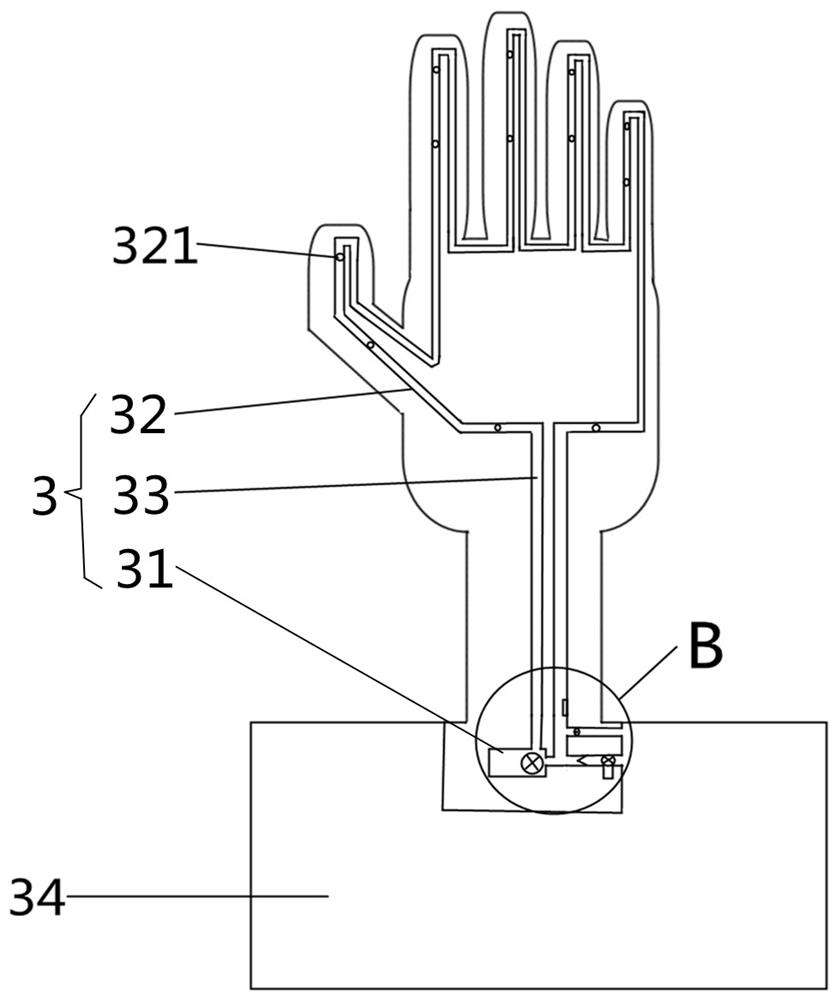 Medical model for treating acupuncture injury of hand