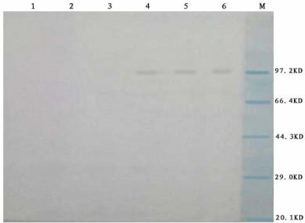 Poultry IL-2 and newcastle disease virus HN gene recombination fusion protein and application thereof