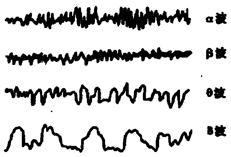 Electroencephalogram abnormal signal detection device and method