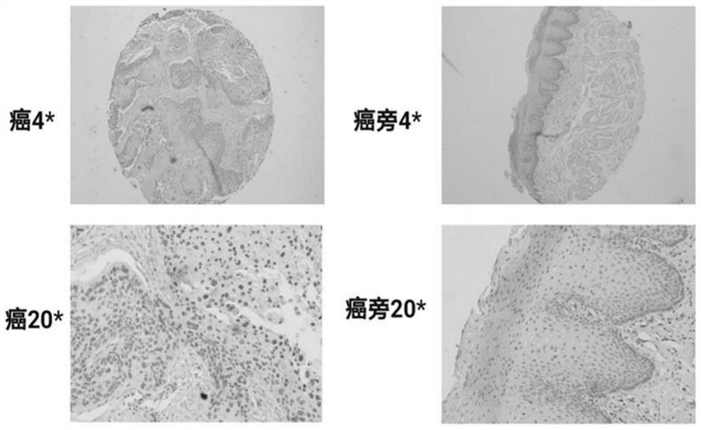 myadm-targeted siRNAs and their applications