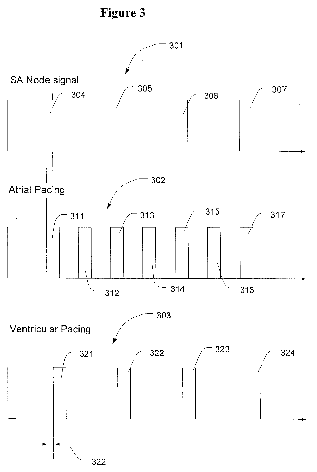 Methods and Apparatus to Stimulate the Heart