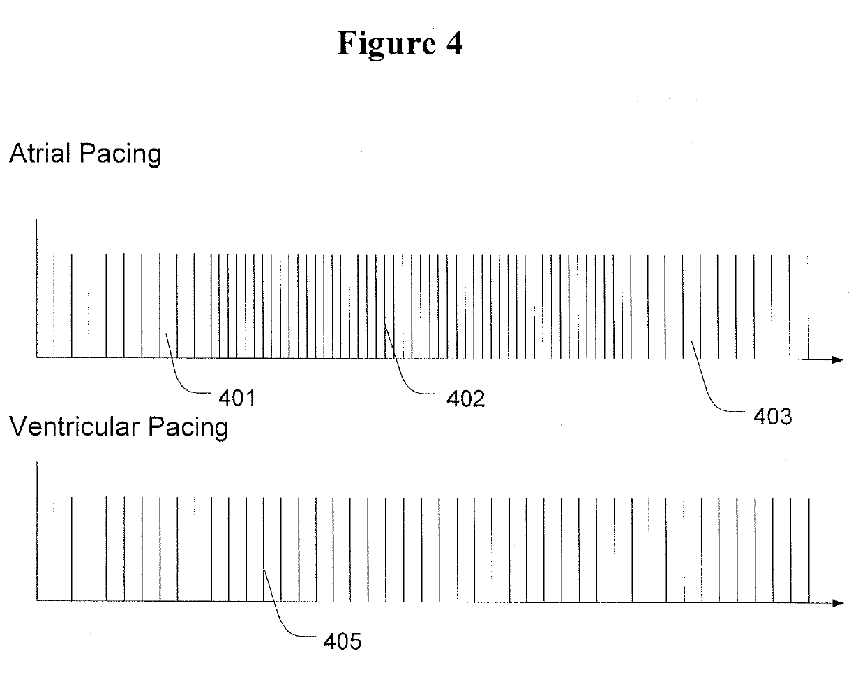 Methods and Apparatus to Stimulate the Heart