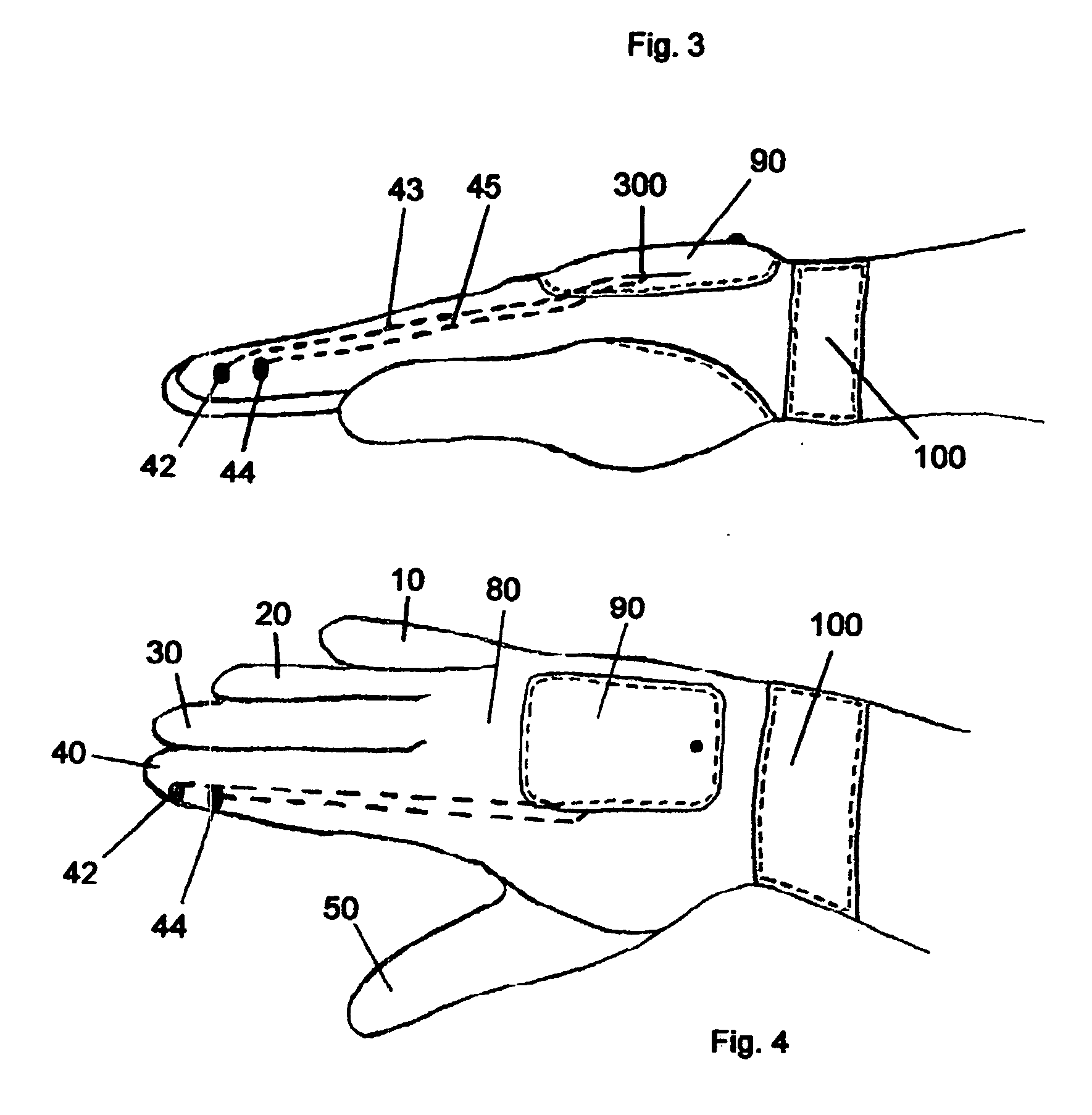 Versatile stun glove