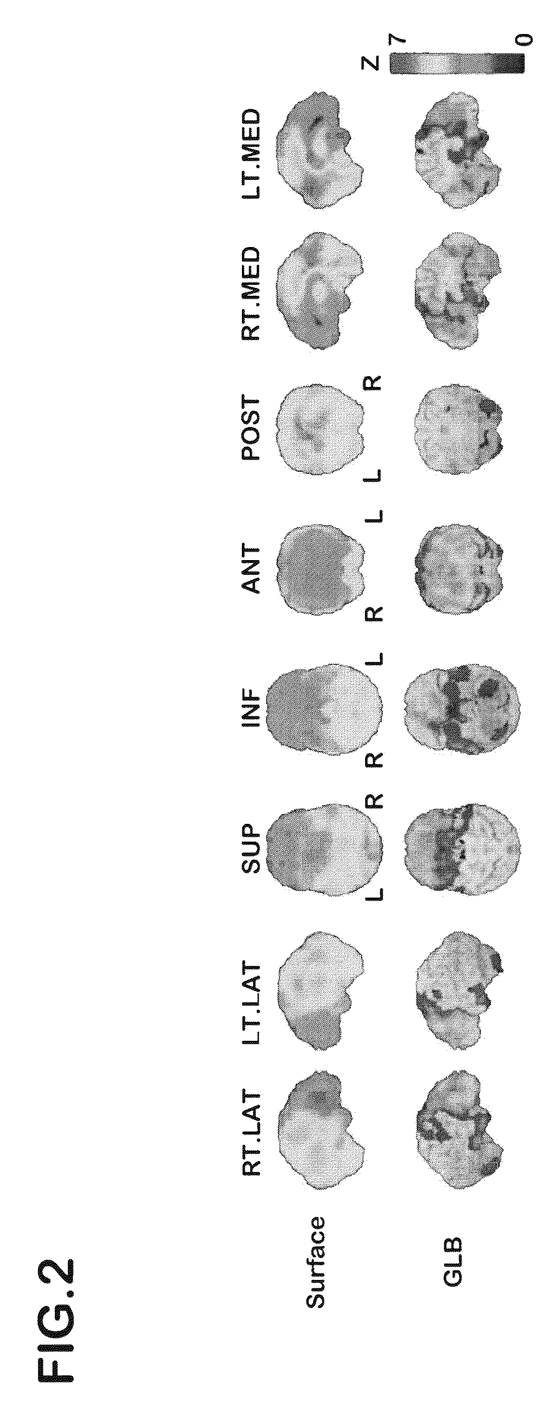 Device for generating alternative of normal brain database